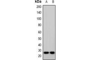 Western blot analysis of IMP3 expression in Hela (A), HepG2 (B) whole cell lysates. (IMP3 Antikörper  (C-Term))