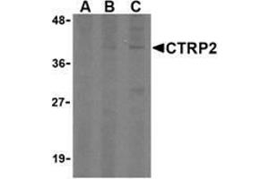 Western blot analysis of CTRP2 in 3T3 (Balb) cell lysate with AP30248PU-N CTRP2 (IN) antibody at (A) 1, (B) 2, and (C) 4 μg/ml. (C1QTNF2 Antikörper  (Intermediate Domain))