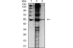 Western Blotting (WB) image for anti-Cholinergic Receptor, Nicotinic, epsilon (Muscle) (CHRNE) (AA 21-239) antibody (ABIN5684149)