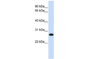 SNAP23 antibody used at 1 ug/ml to detect target protein. (SNAP23 Antikörper  (N-Term))