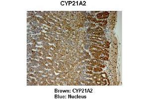 Sample Type : Monkey adrenal gland  Primary Antibody Dilution :  1:25  Secondary Antibody: Anti-rabbit-HRP  Secondary Antibody Dilution:  1:1000  Color/Signal Descriptions: Brown: CYP21A2 Blue: Nucleus  Gene Name: CYP21A2  Submitted by: Jonathan Bertin, Endoceutics Inc. (CYP21A2 Antikörper  (C-Term))