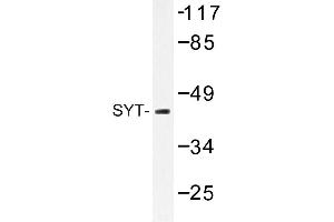 Image no. 1 for anti-Synaptotagmin I (SYT1) antibody (ABIN272235) (SYT1 Antikörper)