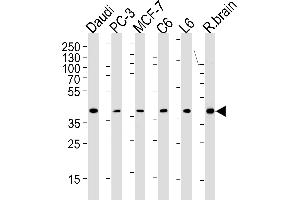 CREB3L4 Antibody (M01) (ABIN1882047 and ABIN2838479) western blot analysis in Daudi,PC-3,MCF-7,rat C6 and L6 cell line ,rat brain tissue lysates (35 μg/lane). (CREB3L4 Antikörper  (AA 1-300))