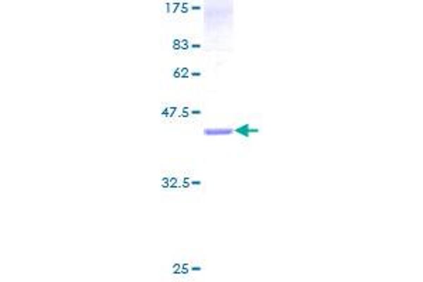 CENPA Protein (AA 1-114) (GST tag)