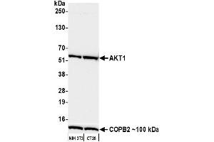Western Blotting (WB) image for anti-V-Akt Murine Thymoma Viral Oncogene Homolog 1 (AKT1) (AA 100-150) antibody (ABIN7795634)