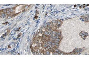 ABIN6277086 at 1/100 staining Human prostate tissue by IHC-P. (PDE1B Antikörper  (C-Term))