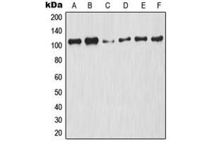 Western blot analysis of NF-kappaB p105 (pS927) expression in HeLa UV-treated (A), A2780 (B), NIH3T3 (C), Raw264. (NFKB1 Antikörper  (C-Term, pSer927))