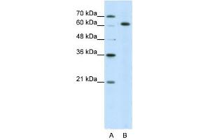 SNRP70 antibody used at 5 ug/ml to detect target protein. (SNRNP70 Antikörper)