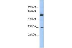 Image no. 1 for anti-Glutathione S-Transferase mu 3 (Brain) (GSTM3) (AA 143-192) antibody (ABIN6743751)