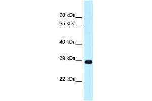 WB Suggested Anti-Dram1 Antibody Titration: 1. (DRAM Antikörper  (N-Term))