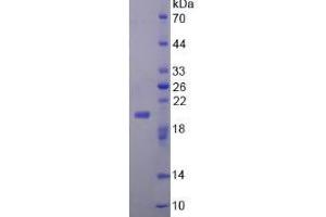 SDS-PAGE analysis of Mouse FGF22 Protein. (FGF22 Protein)
