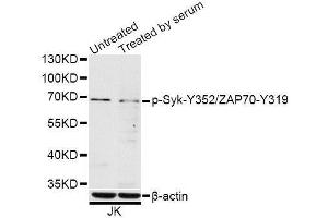 Western blot analysis of extracts of Jurkat cells, using Phospho-Syk-Y352/ZAP70-Y319 antibody (ABIN5996169) at 1/1000 dilution. (SYK Antikörper  (pTyr319, pTyr352))