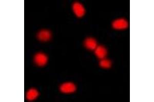 Immunofluorescent analysis of MDM2 staining in NIH3T3 cells.