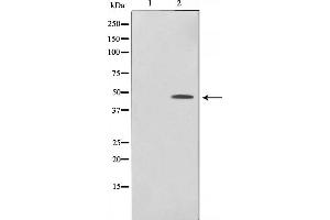 Western blot analysis of c-Jun phosphorylation expression in UV treated HeLa whole cell lysates,The lane on the left is treated with the antigen-specific peptide. (C-JUN Antikörper  (pSer243))