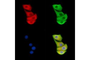 ABIN6262399 and ABIN6278869 staining Hela cells by IF/ICC.