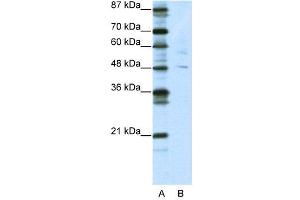 WB Suggested Anti-PLAGL1  Antibody Titration: 5. (PLAGL1 Antikörper  (N-Term))