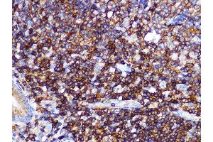 Immunohistochemistry of paraffin-embedded human appendix using PI3 Kinase p85 alpha Rabbit mAb (ABIN7269319) at dilution of 1:100 (40x lens). (PIK3R1 Antikörper)