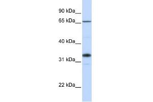 Western Blotting (WB) image for anti-UDP-Gal:betaGlcNAc beta 1,3-Galactosyltransferase, Polypeptide 1 (B3GALT1) (C-Term) antibody (ABIN2783817)