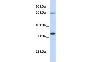 WB Suggested Anti-B3GALT1 Antibody Titration:  0. (B3GALT1 Antikörper  (C-Term))