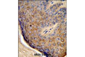 Formalin-fixed and paraffin-embedded human skin tissue reacted with TCHP Antibody , which was peroxidase-conjugated to the secondary antibody, followed by DAB staining. (TCHP Antikörper  (AA 291-320))