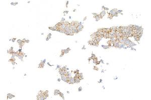 Immunocytochemistry (ICC) image for anti-Receptor tyrosine-protein kinase erbB-2 (ErbB2/Her2) (AA 1205-1255) antibody (ABIN7455181) (Rekombinanter ErbB2/Her2 Antikörper  (AA 1205-1255))