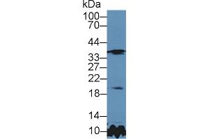 Western Blot; Sample: Rat Cerebrum lysate; Primary Ab: 5µg/ml Rabbit Anti-Rat TIMP3 Antibody Second Ab: 0. (TIMP3 Antikörper  (AA 27-209))