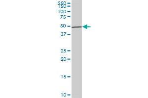LHX5 monoclonal antibody (M05), clone 2B11. (LHX5 Antikörper  (AA 136-235))