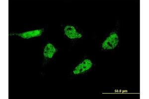 Immunofluorescence of monoclonal antibody to C17orf88 on HeLa cell. (FAM215A Antikörper  (AA 28-114))