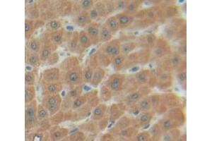 IHC-P analysis of Human Tissue, with DAB staining. (SULT1A1 Antikörper  (AA 2-295))