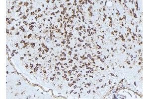 ABIN6272976 at 1/100 staining Rat brain tissue by IHC-P. (PSAT1 Antikörper  (Internal Region))