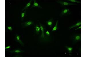 Immunofluorescence of monoclonal antibody to PKM2 on HeLa cell. (PKM2 Antikörper  (AA 436-531))