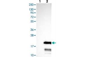 Western blot analysis of Lane 1: Negative control (vector only transfected HEK293T lysate), Lane 2: Over-expression Lysate (Co-expressed with a C-terminal myc-DDK tag (~3. (C11ORF52 Antikörper)