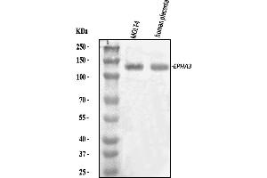 Western blot analysis of Eph Receptor A3/EPHA3 using anti-Eph Receptor A3/EPHA3 antibody (ABIN7602102).