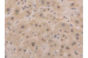 Used in DAB staining on fromalin fixed paraffin- embedded liver tissue (GAPDH Antikörper  (AA 2-148))