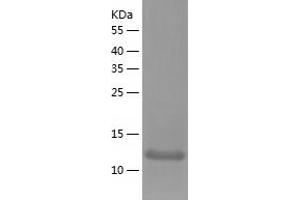 Western Blotting (WB) image for Pleckstrin Homology Domain Interacting Protein (PHIP) (AA 1146-1287) protein (His tag) (ABIN7288129) (PHIP Protein (AA 1146-1287) (His tag))