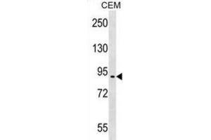 Western Blotting (WB) image for anti-erythrocyte Membrane Protein Band 4.1 Like 4A (EPB41L4A) antibody (ABIN2999324) (EPB41L4A Antikörper)