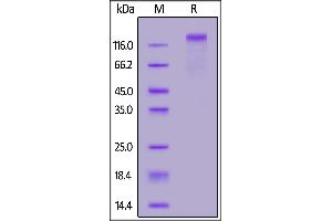 SDS-PAGE (SDS) image for Protein tyrosine Phosphatase, Receptor Type, C (PTPRC) (AA 26-577) protein (His tag,AVI tag,Biotin) (ABIN7013675)