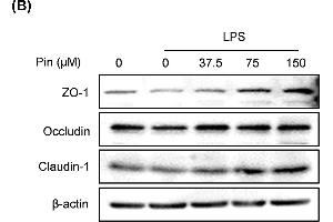 Pinocembrin increased the expression of tight junction proteins in vitro(A) Caco-2 cells were treated with different concentration of pinocembrin (0-150 μM) for 24 h, and then the mRNA expression of Occludin, Claudin-1 and JAM-A in Caco-2 cells were determined by qRT-PCR. (TJP1 Antikörper  (AA 1600-1700))