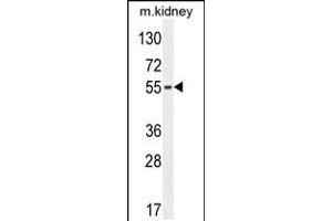 Western blot analysis in mouse kidney tissue lysates (35ug/lane). (FBXO39 Antikörper  (C-Term))