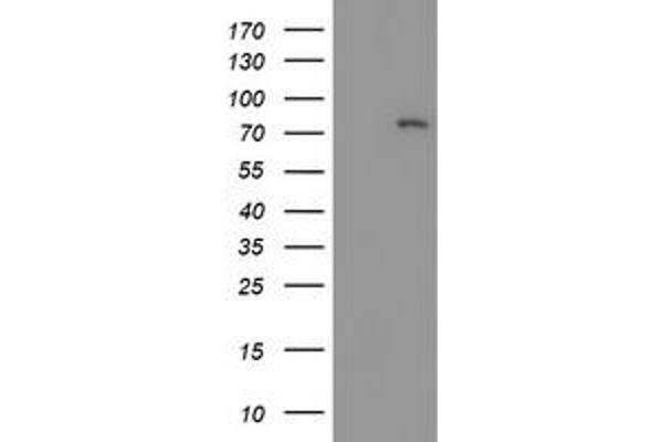 LIM Domain Kinase 1 Antikörper