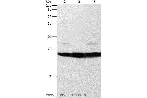 Western blot analysis of Mouse liver and brain tissue, A549 cell, using SIGMAR1 Polyclonal Antibody at dilution of 1:310 (SIGMAR1 Antikörper)