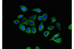 Immunofluorescent analysis of A549 cells using ABIN7145918 at dilution of 1:100 and Alexa Fluor 488-congugated AffiniPure Goat Anti-Rabbit IgG(H+L) (CCR1 Antikörper  (AA 314-362))