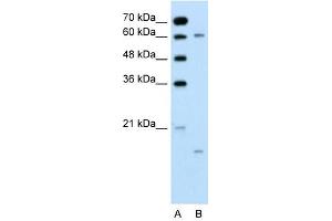 CYP4A22 antibody used at 0.