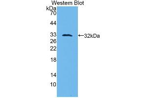 Western blot analysis of the recombinant protein. (PLAU Antikörper  (AA 180-433))