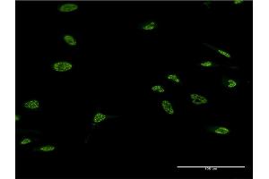 Immunofluorescence of monoclonal antibody to LHX4 on HeLa cell. (LHX4 Antikörper  (AA 291-390))