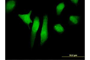 Immunofluorescence of monoclonal antibody to PTPN12 on HeLa cell. (PTPN12 Antikörper  (AA 682-779))