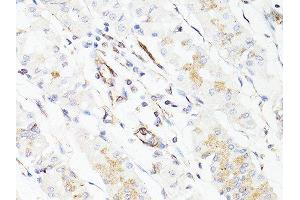 Immunohistochemistry of paraffin-embedded human stomach using VIM antibody. (Vimentin Antikörper  (AA 1-101))