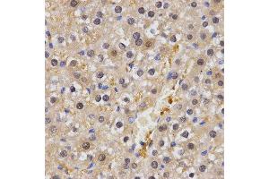 Immunohistochemistry (IHC) image for anti-Heat shock factor protein 2 (HSF2) antibody (ABIN3016593) (HSF2 Antikörper)