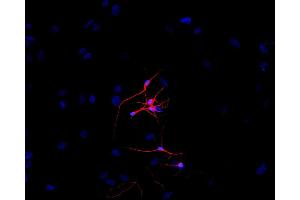 Immunofluorescence staining of P-19 mouse embryonal carcinoma cell line stimulated to neuronal differentiation by retinoic acid. (TUBB3 Antikörper  (N-Term) (FITC))