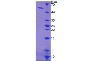 Image no. 1 for Thymidine Kinase 1, Soluble (TK1) (AA 2-234) protein (His tag,GST tag) (ABIN6236918) (TK1 Protein (AA 2-234) (His tag,GST tag))